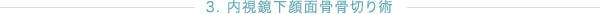 3. 内視鏡下顔面骨骨切り術