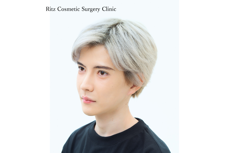 症例写真：ルフォーI型骨切り術（LeFort-1）＋下顎枝矢状分割術（SSRO）上方移動：7㎜＋後方移動：2㎜＋オトガイ水平骨切り術（中抜き：6㎜短縮+2㎜前進）＋頬骨縮小術＋下顎形成術（下顎角切除）