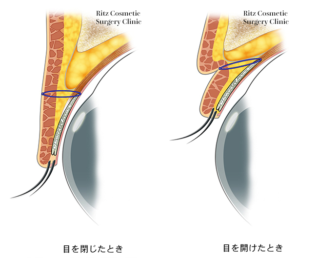 目を閉じたときと、目を開けたときのイメージ