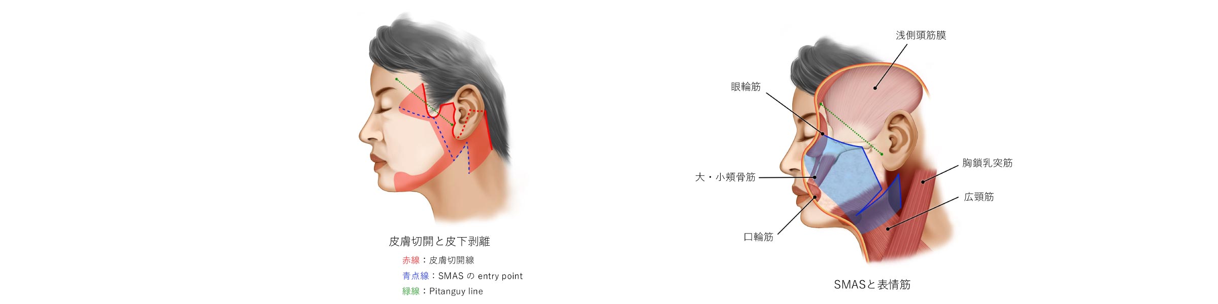 おとがい形成における基準値