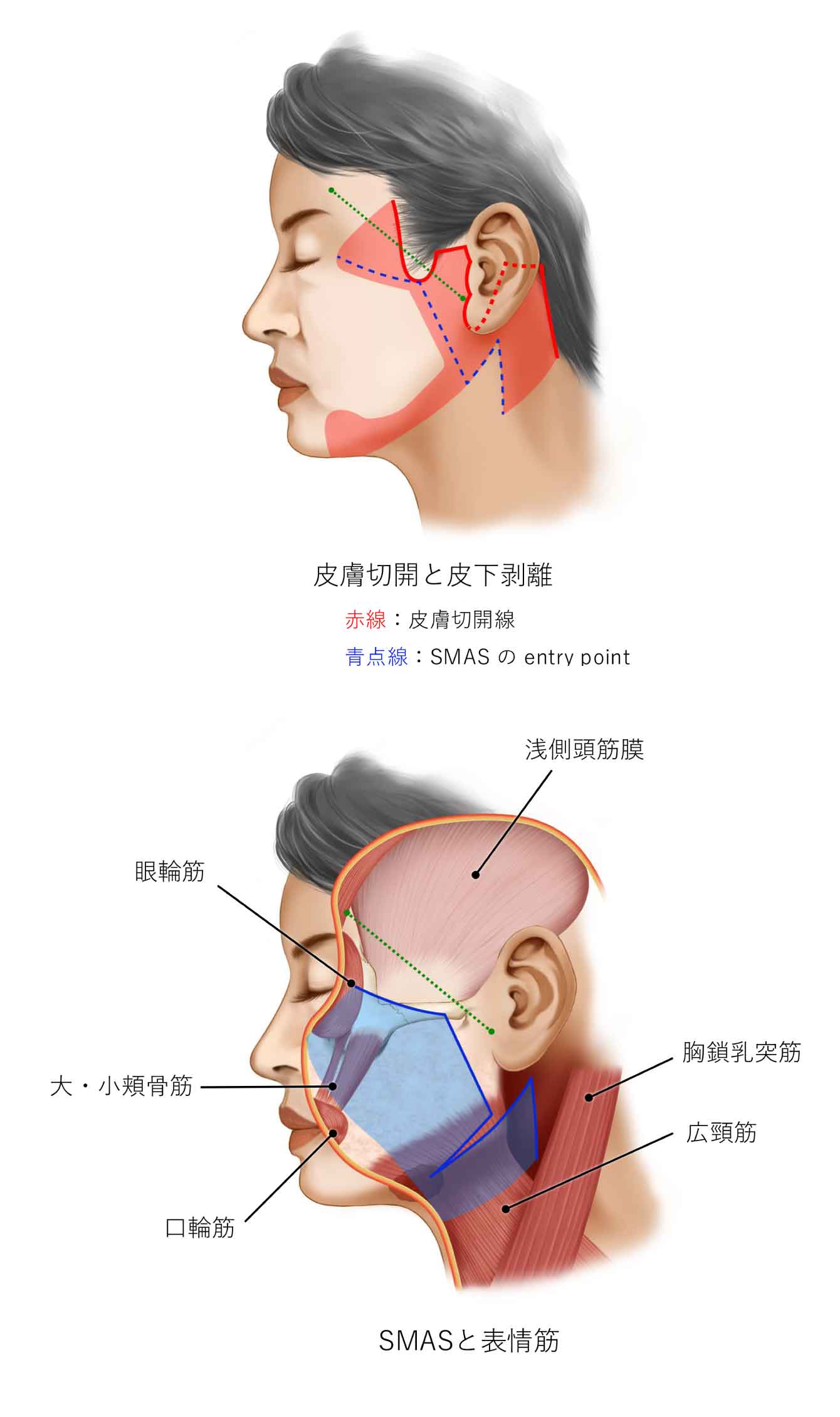 おとがい形成における基準値