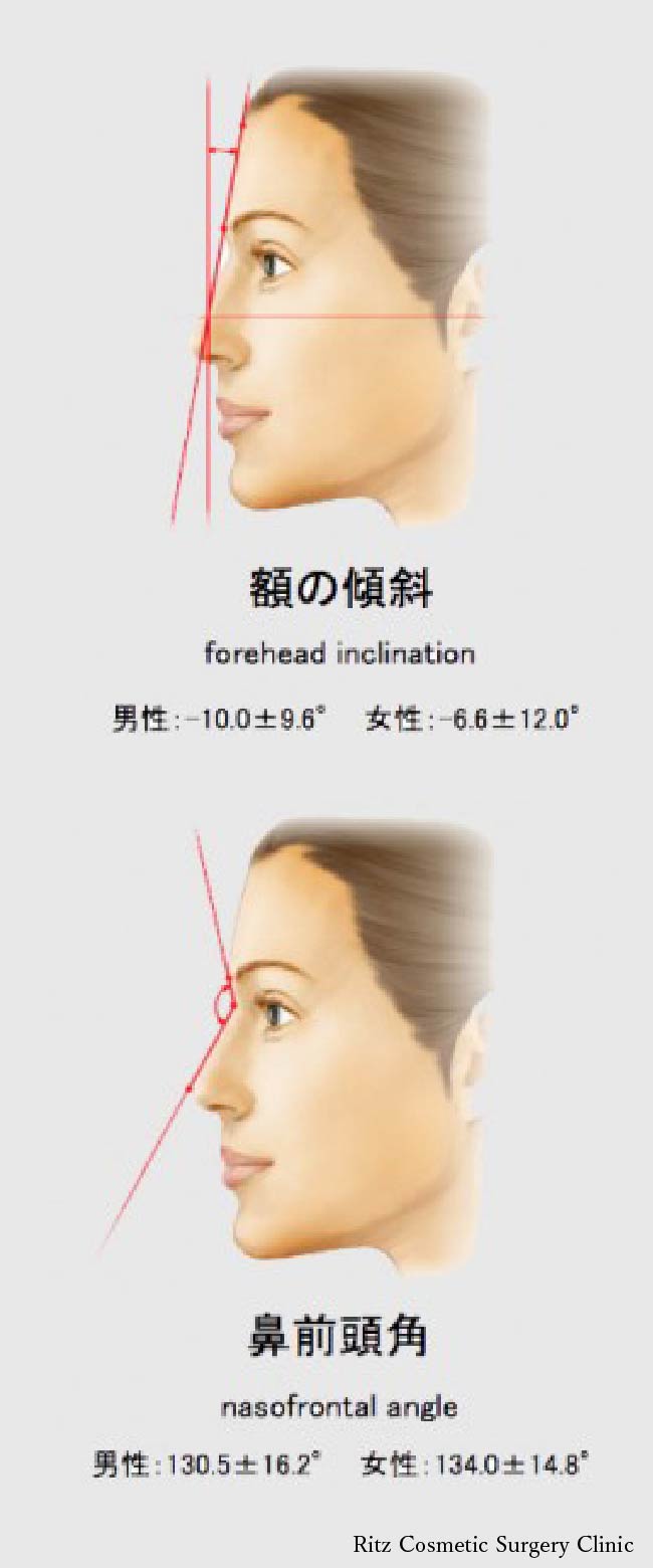 額の美容整形手術 美容整形ならリッツ美容外科東京院