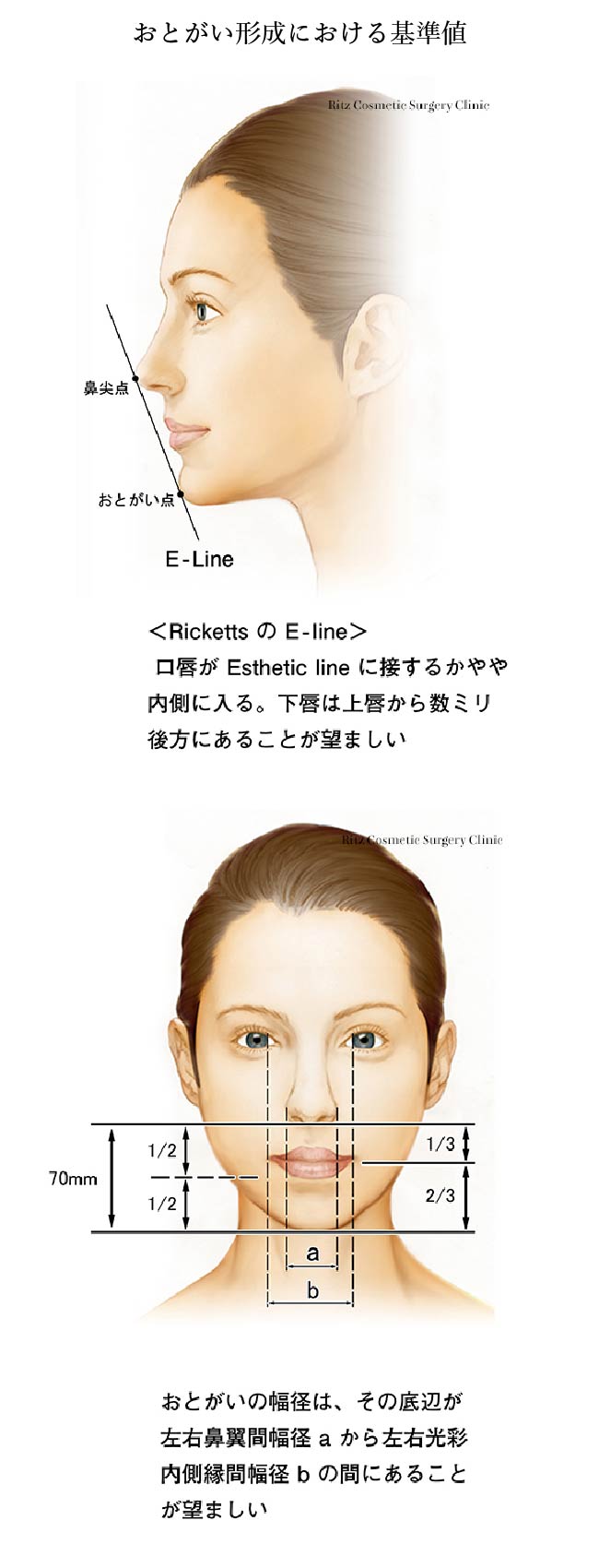 おとがい形成における基準値