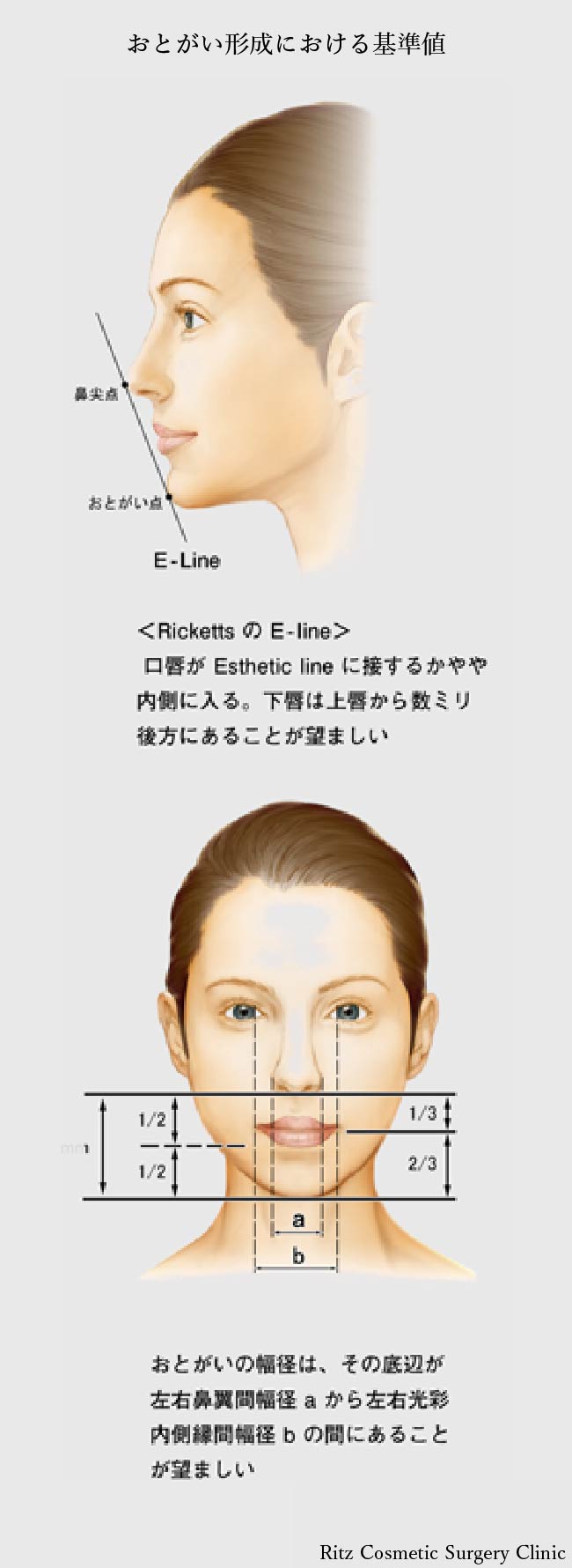 オトガイ狭小術 顎を細くする の美容整形手術 美容整形ならリッツ美容外科東京院