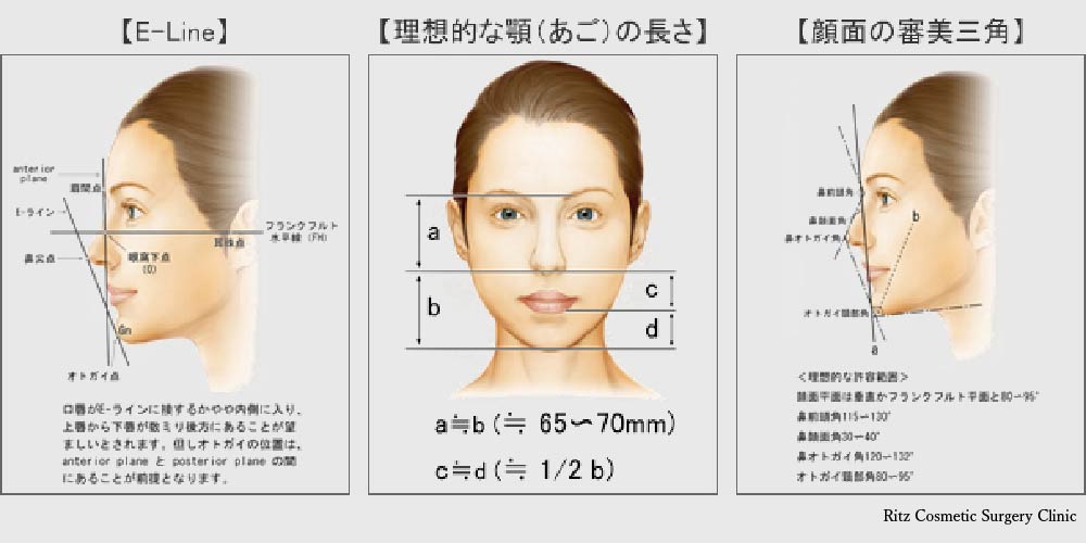 術前の評価、E-Line、理想的な顎の長さ、顔面の審美三角