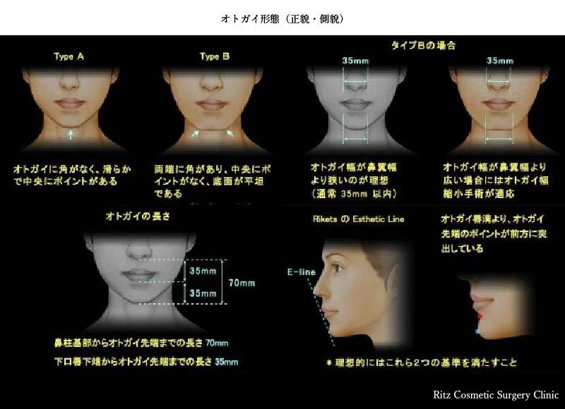 面長 オトガイ 顎削りなど の輪郭美容整形手術 美容整形ならリッツ美容外科東京院