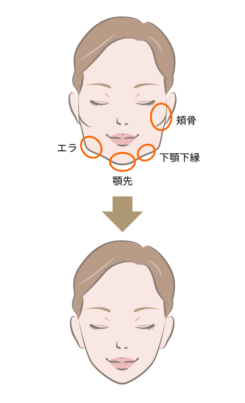 輪郭3点とは