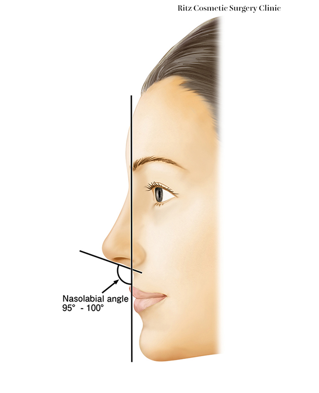 鼻柱口唇角(columellar -labial angle)