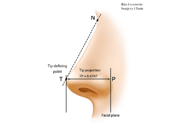 横顔の尖（鼻先）に適度な高さがあり、突出点（tip defining point：TDP）の位置のバランスが取れているイメージ