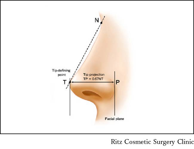 横顔の尖（鼻先）に適度な高さがあり、突出点（tip defining point：TDP）の位置のバランスが取れているイメージ
