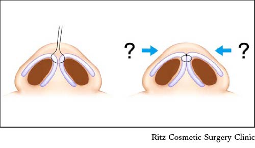 鼻尖（鼻先）の両端での高低差を出すイメージ