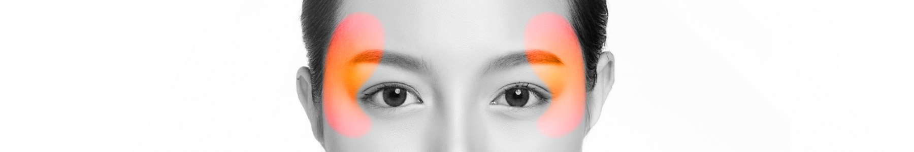 こめかみリフト