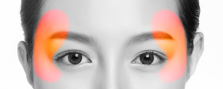 こめかみリフト