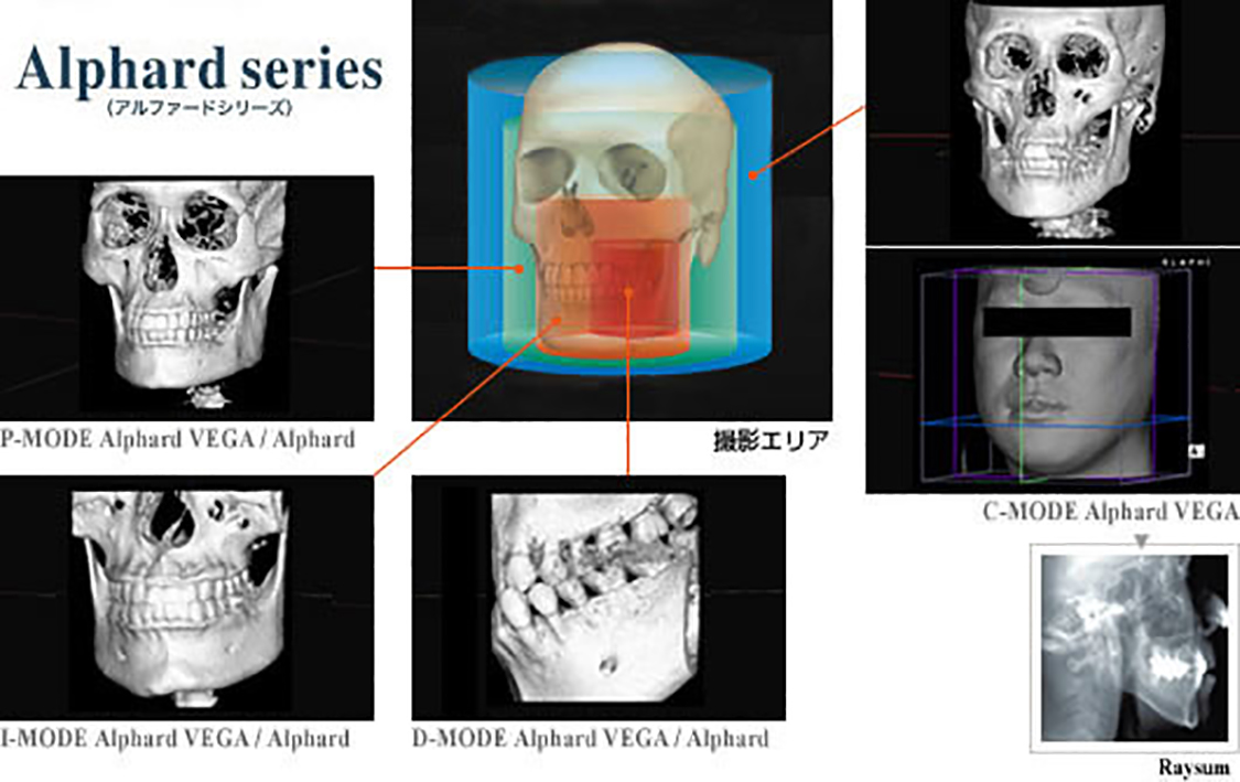 Alphard VEGA　撮影モードとエリア(デンタルエリアからセファロエリアまで)