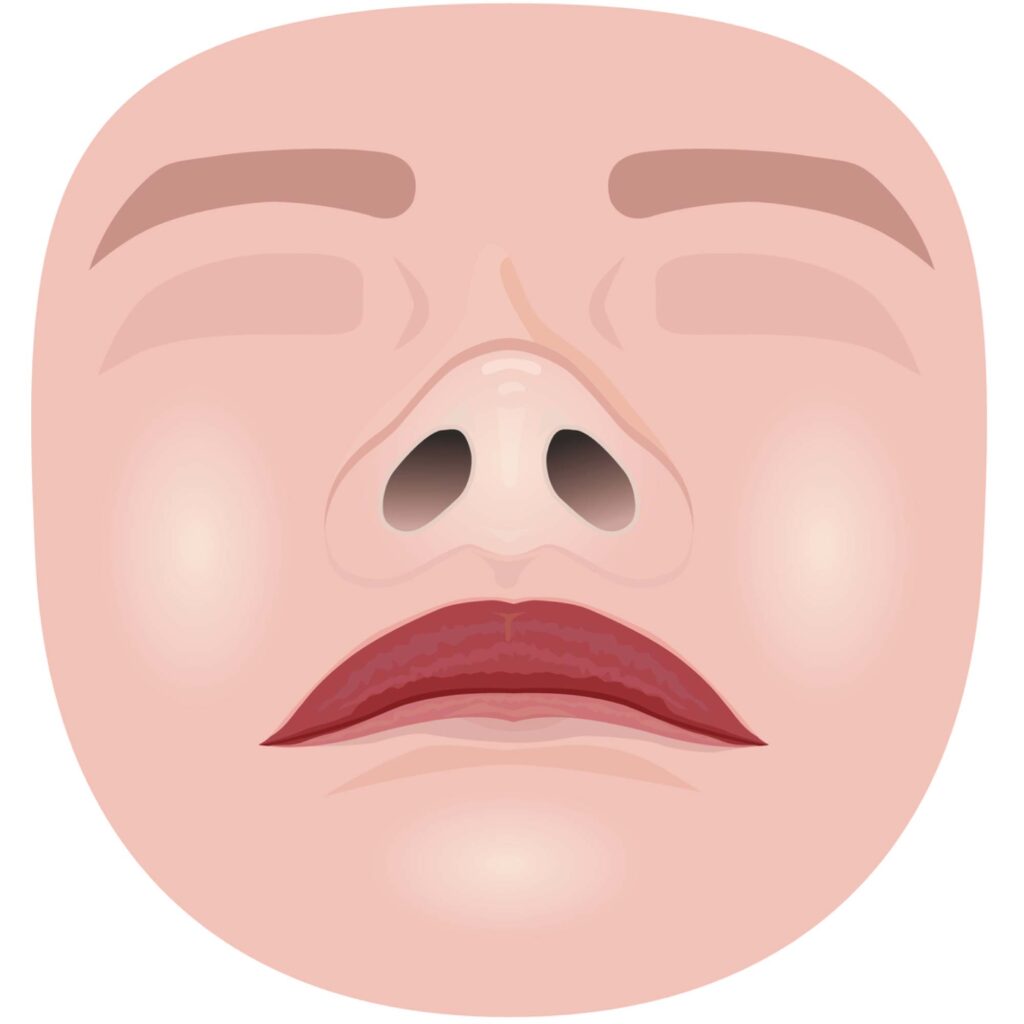 団子鼻の顔のイメージ